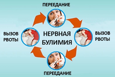 Лечение булимии в Южно-Сахалинске